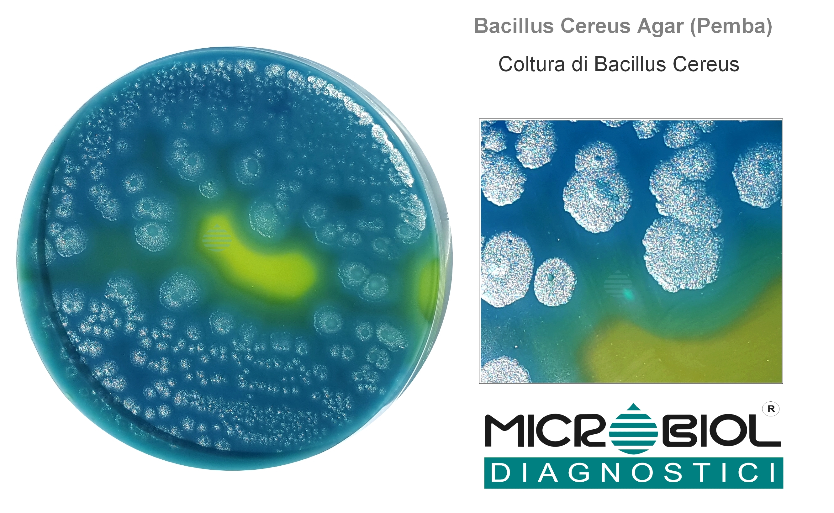 BACILLUS CEREUS AGAR (PEMBA)